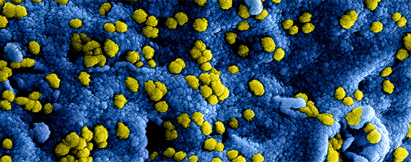 Closeup of viruses